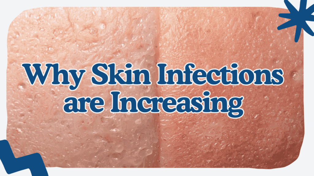 Skin infections are increasing at an alarming rate. DERMAGLOVE creates products reducing these infections through their holistic ingredients.